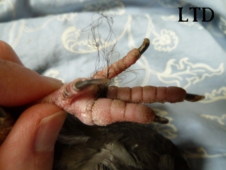 Pigeon foot tangled in hair